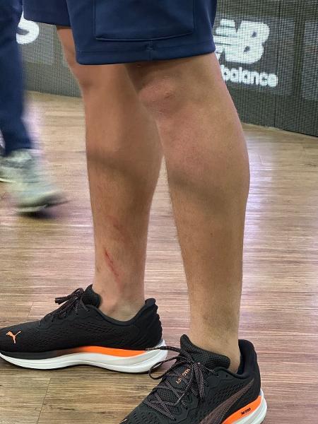 Pablo Maia com a perna machucada, após empate com o Palmeiras no Morumbis