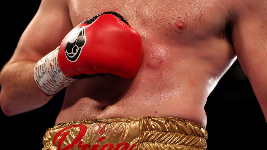 O boxeador David Price foi mordido por Kash Ali durante uma luta - LEE SMITH/Action Images via Reuters