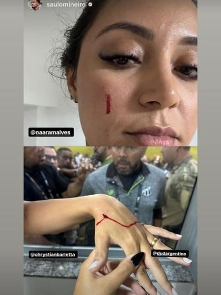 Nenê feriu familiares de atletas do Ceará após quebrar vidro de um dos camarotes do estádio Presidente Vargas