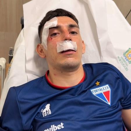 Gonzalo Escobar, lateral do Fortaleza, está entre os jogadores feridos após ataque a ônibus por torcedores do Sport