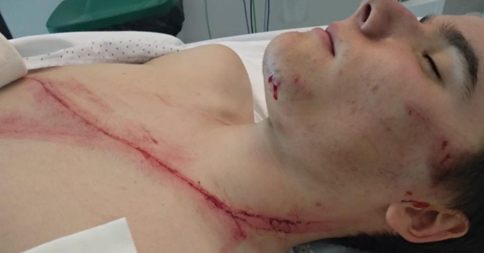 Ciclista Andoni Azkarate ficou com grande cicatriz após choque com guard-rail
