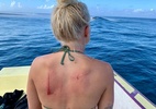 Surfista brasileira se fere em bancada de corais antes de etapa do Mundial - Reprodução/Instagram