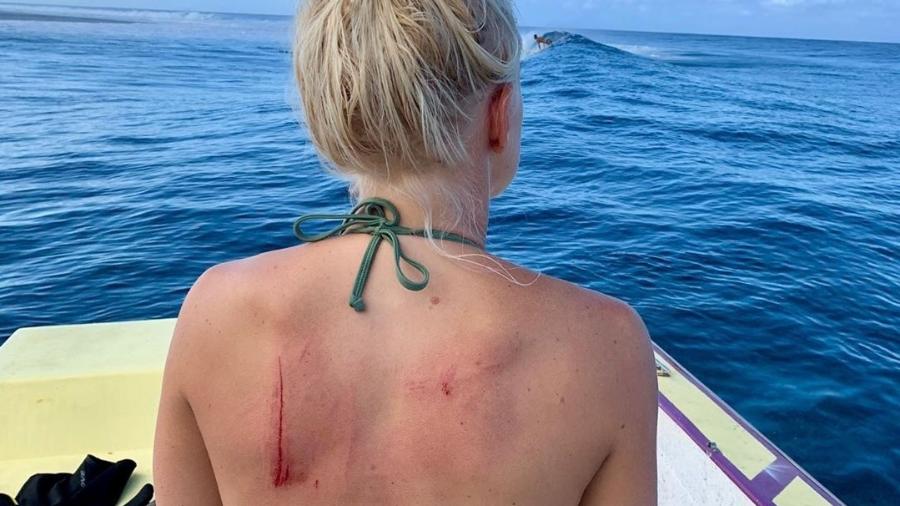 Tatiana Weston-Webb se fere em bancada de corais antes de etapa do Mundial - Reprodução/Instagram