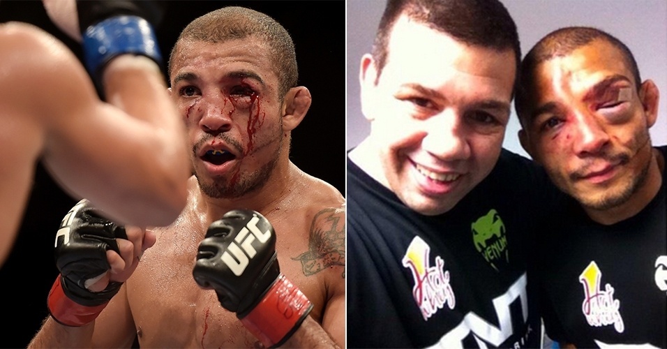 José Aldo ficou "estragado" após seu segundo combate contra Chad Mendes - Inovafoto e Reprodução/Instagram