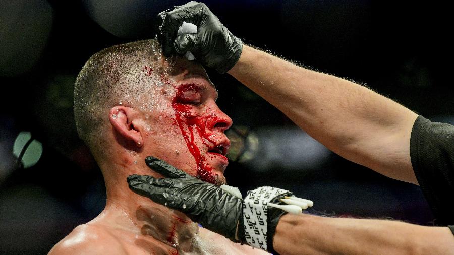 Nate Diaz sofreu corte durante luta contra Jorge Masvidal - Steven Ryan/Getty Images/AFP