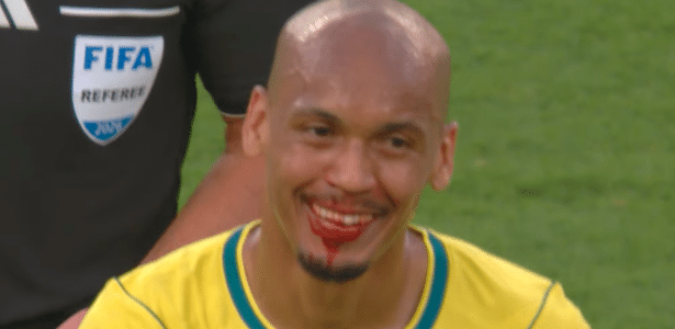 Fabinho sofre sangramento no nariz e é atendido durante Brasil x Marrocos