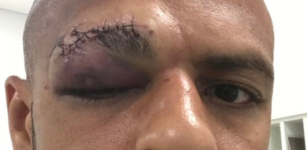 Felipe Melo - Facebook/Reprodução - Facebook/Reprodução