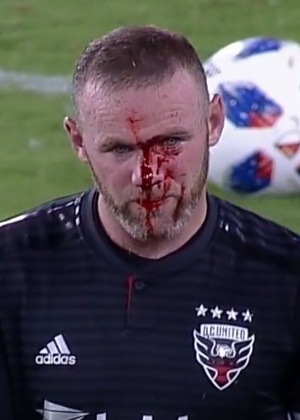 Rooney sangra após choque em partida da MLS - Reprodução/Twitter - Reprodução/Twitter
