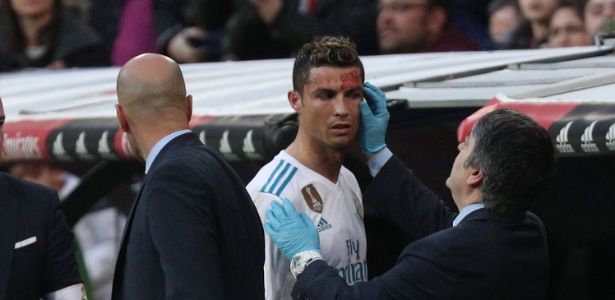 Cristiano Ronaldo é atendido após sofrer corte no rosto - SERGIO PEREZ/REUTERS - SERGIO PEREZ/REUTERS
