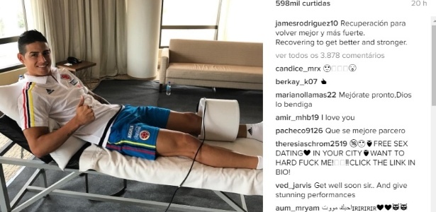 James Rodriguez em recuperação na seleção colombiana - Reprodução/Instagram