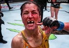 Estrela do UFC tira onda sem os dentes após vitória: 