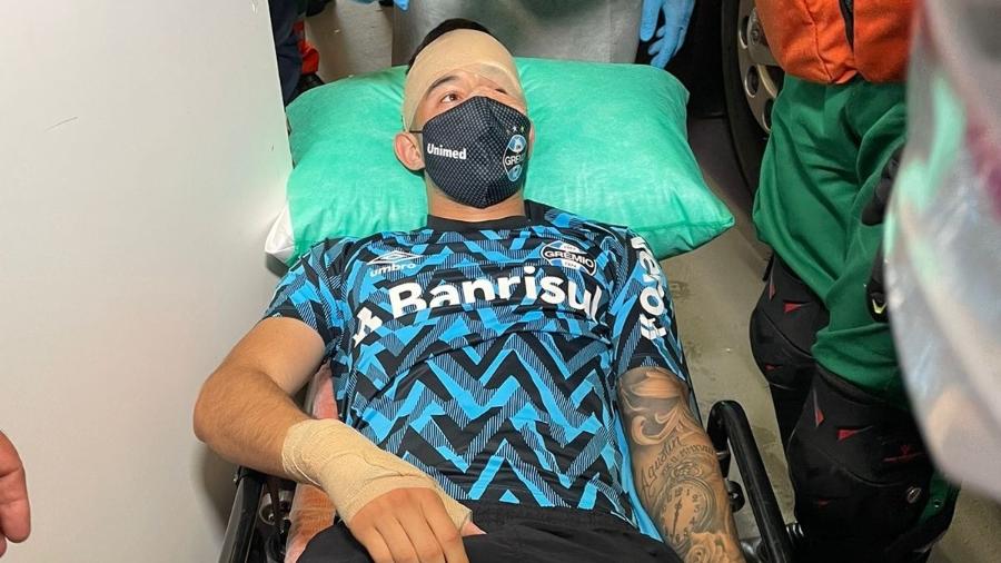 Villasanti, do Grêmio, ficou ferido em ataque ao ônibus da delegação nas proximidades do Beira-Rio - Lucas Uebel/UOL