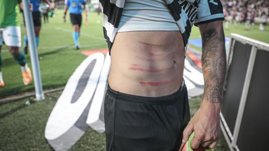 Guga, lateral do Atlético-MG, exibe as marcas da chuteira de Danilo Barcelos, do Goiás - Pedro Souza/Atlético-MG