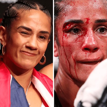 Rosto de Amanda Serrano antes e depois da luta contra Katie Taylor