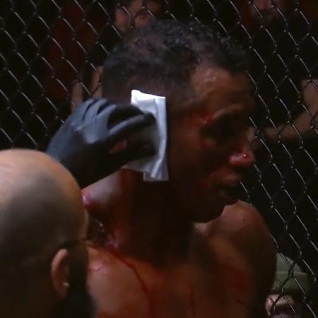 Brasileiro Vinicius Cruz sofre lesão grave na orelha em evento de MMA na Rússia