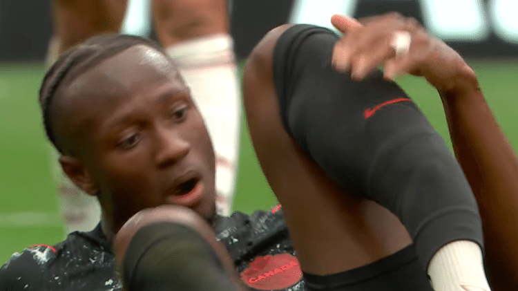 Koné, do Canadá, fraturou a perna durante jogo contra o Qatar