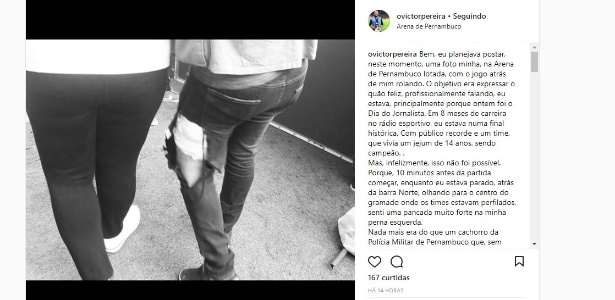 Foto mostra como ficou a perna do repórter depois do ocorrido - Reprodução/Instagram