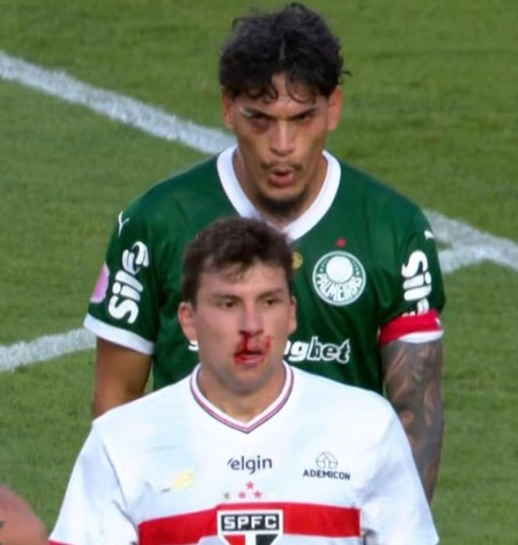 Gustavo Gómez dan Tapia juga membintangi film kontroversial - Reproduksi