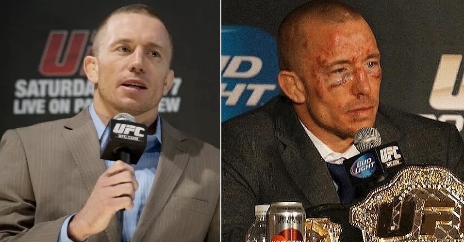 Georges St-Pierre vence, mas geralmente fica cheio de cortes e hematomas. "Tenho pele de bebê", costuma dizer - Getty Images e Reprodução