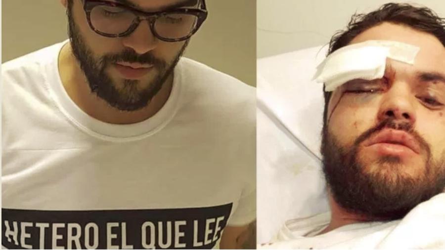 O jogador de rúgbi Jonathan Castellari foi agredido em Buenos Aires por ser gay - Reprodução Twitter