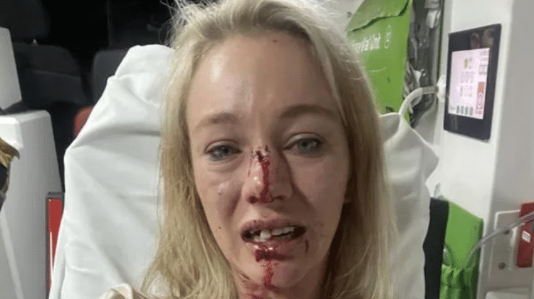 A jóquei Sonja Wiseman teve o nariz quebrado após ser atacada