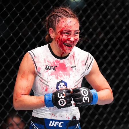 Golpes da brasileira Marina Rodriguez deixaram o rosto de Michelle Waterson-Gomez desfigurado