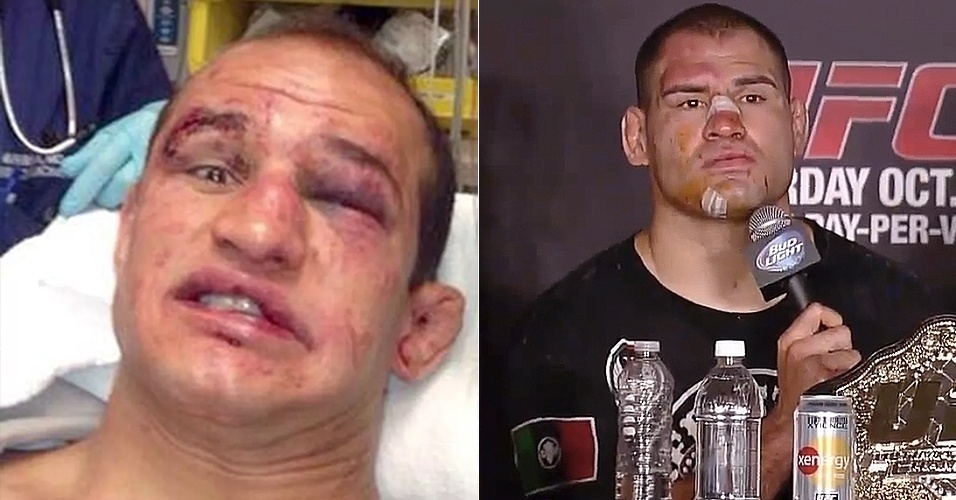 A terceira luta entre Cigano e Velásquez foi parecida: Cigano no hospital, mas desta vez bem humorado, e Velásquez também bastante avariado - Reprodução/Instagram e Reprodução