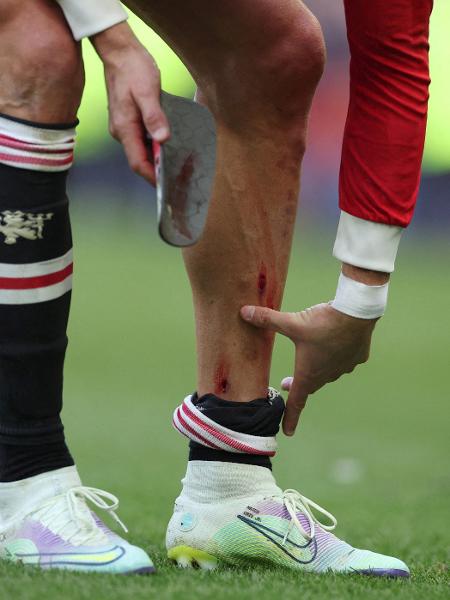 Cristiano Ronaldo deixou o gramado do Goodison Park com a perna ensanguentada após Everton x Manchester United - Phil Noble/Reuters