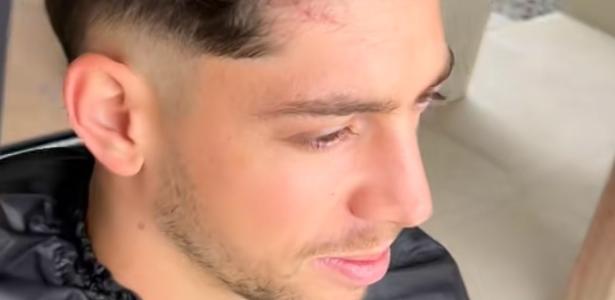 Barbeiro mostra cicatriz na cabeça de Valverde após briga no Real; veja