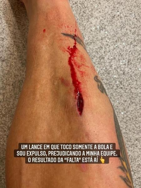 Fagner, do Corinthians, comenta expulsão contra o Atlético-GO, pela Copa do Brasil, em seu Instagram - Reprodução/Instragram