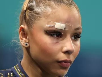 Flávia cai e machuca supercílio antes de final da ginástica das Olimpíadas