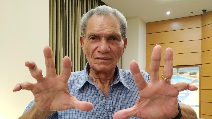 Manga, ex-goleiro de Botafogo e Inter, mostra dedos quebrados ao longo da carreira - Vanderlei Lima/UOL
