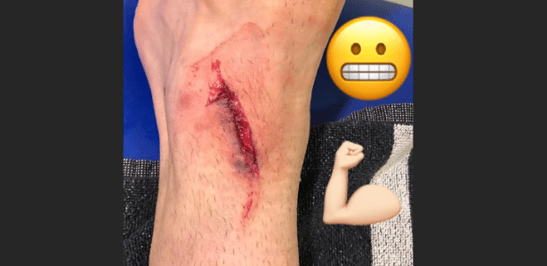 O atacante croata Mario Mandzukic mostra corte na perna - Reprodução/Twitter