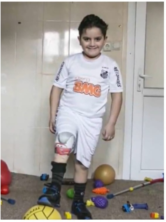 Sem uma perna desde bebê, menino se dedica ao futebol e sonha em