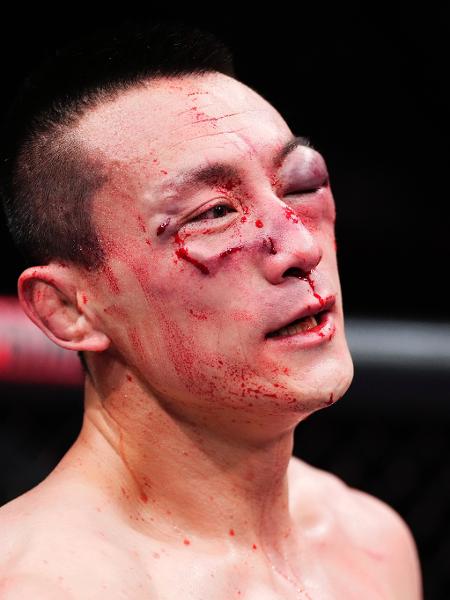 Lutador chinês Song Kenan saiu bem machucado de luta no UFC 285 - Jeff Bottari/Zuffa LLC via Getty Images