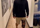 "Passo a passo"; Gabriel Medina segue em recuperação da lesão no joelho - reprodução/Instagram