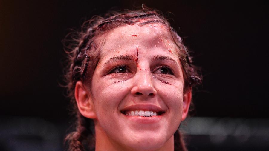 Felicia Spencer fica com rosto machucado após luta com Amanda Nunes - Jeff Bottari/Zuffa LLC