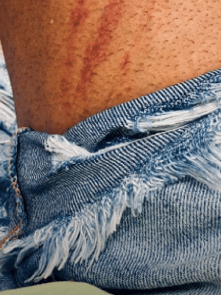 Daniel Alves divulgou imagem da perna após levar entrada dura de Jobson no San-São - Reprodução/Instagram
