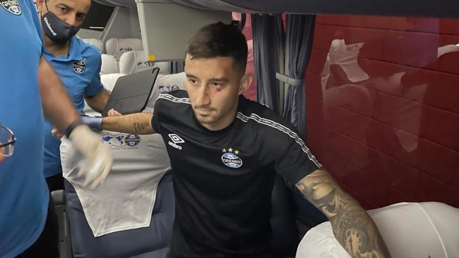 Villasanti ferido com pedrada no ônibus da delegação do Grêmio antes do Gre-Nal - Divulgação