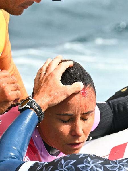 Surfista francesa Johanne Defay sofre corte durante Jogos Olímpicos de Paris 