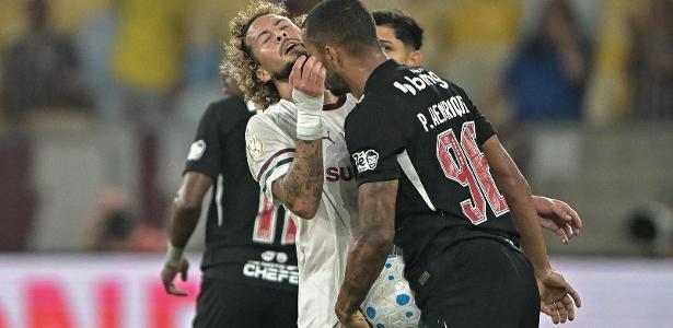 Muitas faltas, zero gol: Vasco e Flu empatam nas oitavas da Copa do Brasil