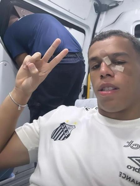 Sandry, volante do Santos, levou cotovelada durante a goleada sobre a Portuguesa - Reprodução