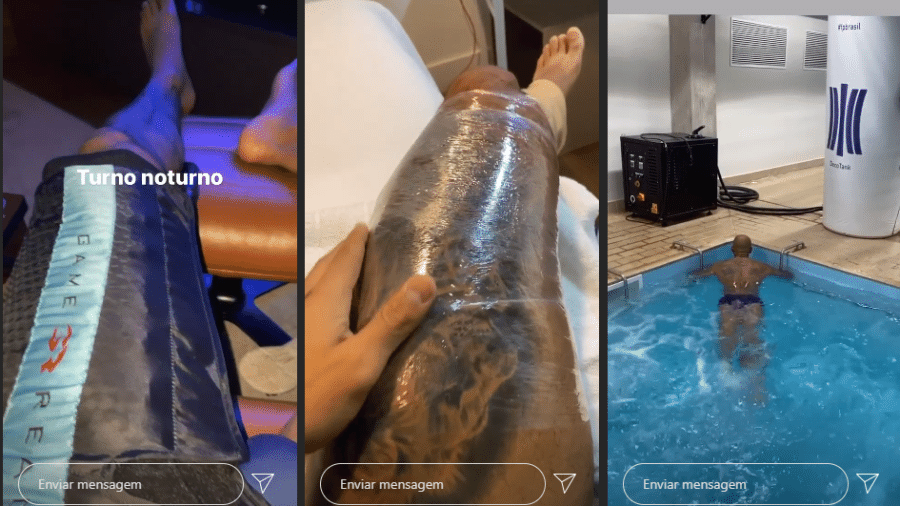 Felipe Melo publicou em seu Instagram fotos e vídeos em que faz tratamento na coxa esquerda - Reprodução/Instagram