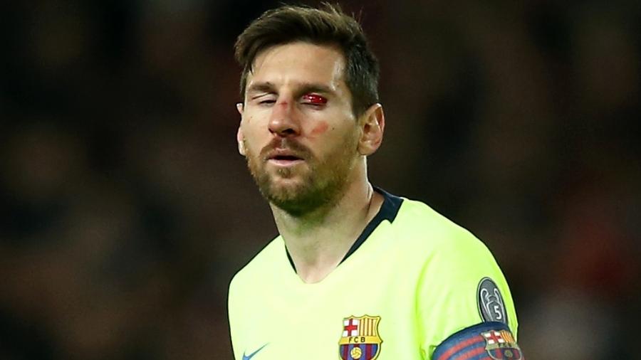 Messi tem rosto machucado durante partida do Barcelona com Manchester United na Liga dos Campeões - Jan Kruger - UEFA/UEFA via Getty Images