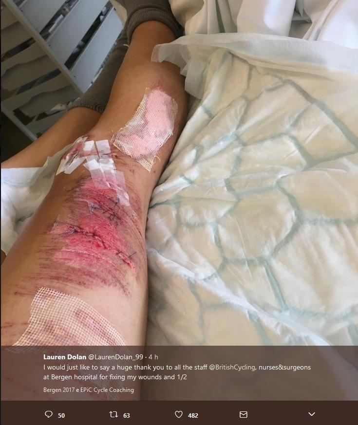Ciclista Lauren Dolan mostra ferimentos após cair durante a prova