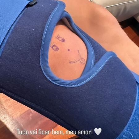 Joelho de Alex Telles ganhou um desenho fofo feito pela mulher do lateral, Vitoria - Reprodução/Instagram