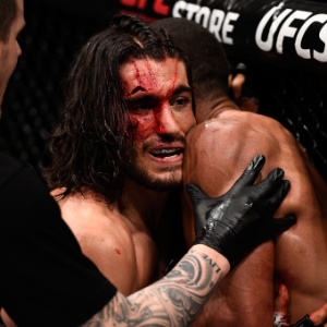 O brasileiro Thiago Marreta deixou o canadense Elias Theodorou, então invicto, com esse corte e venceu sua luta no UFC - undefined