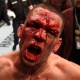 Nate Diaz celebra vitória contra McGregor com a cara ensanguentada - Josh Hedges/Getty Images