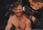 "Explodiu": lutador relata como é ficar com orelha pendurada em um combate - Gaspar Gaúcho/Taura MMA