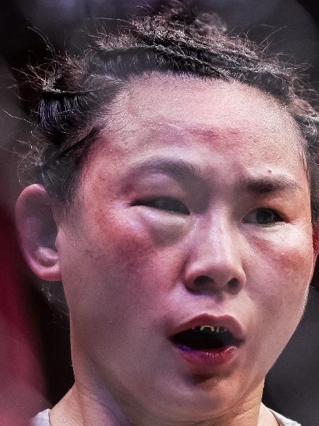 Chinesa Yan Xiaonan ficou com o rosto inchado após ser derrotada pela compatriota e campeã da categoria palha, Zhang Weili, no UFC 300